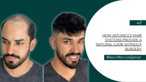 How Advanced Hair Systems Provide a Natural Look Without Surgery
