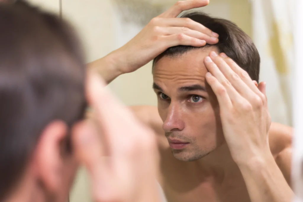 Best Hair Loss Treatments for Men
