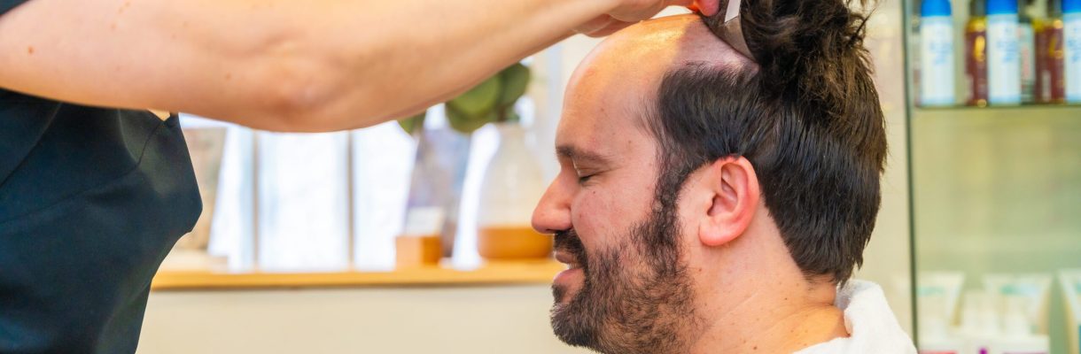 Non Surgical Hair Replacement in Qatar – Hair Revive Qatar